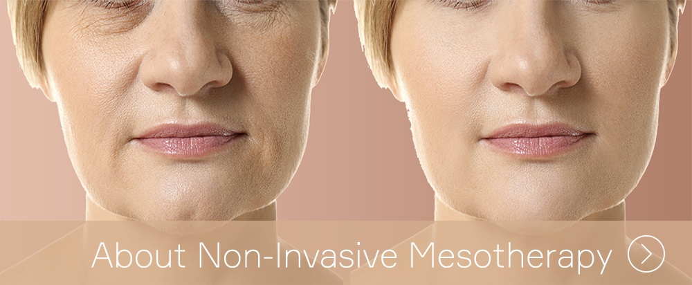 No needle Mesotherapy treatment