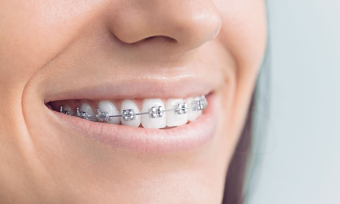 Orthodontic Treatment In Pune