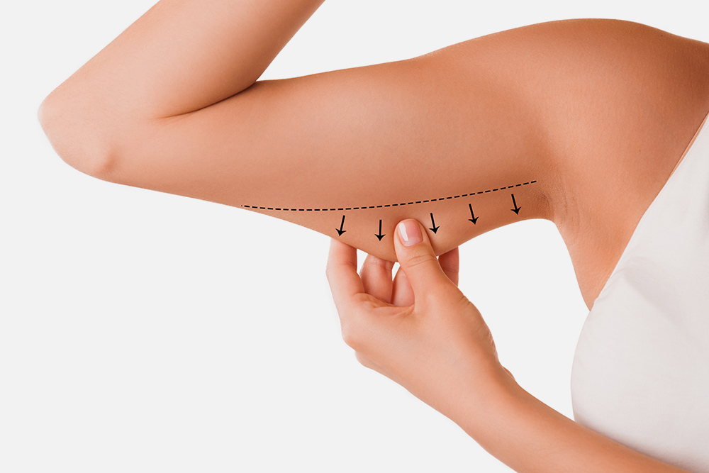 London Liposuction Clinic - Liposuction Surgery | Liposuction Treatment