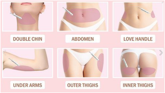 Lipolysis Injections Melbourne | Non Surgical Fat Removal